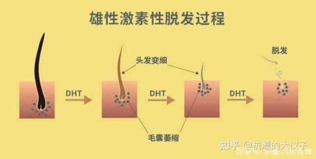 熬夜脱发的原因远比你想的复杂