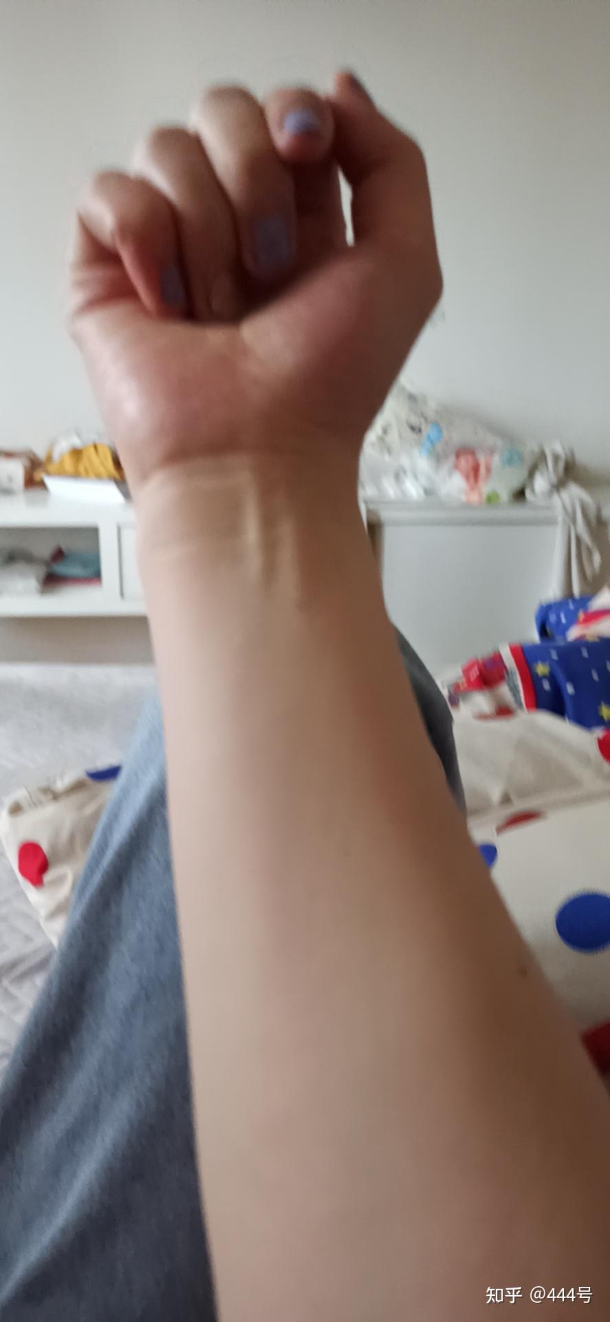 小时候手臂脱臼没接好现在左手不直会不会影响健身动作?