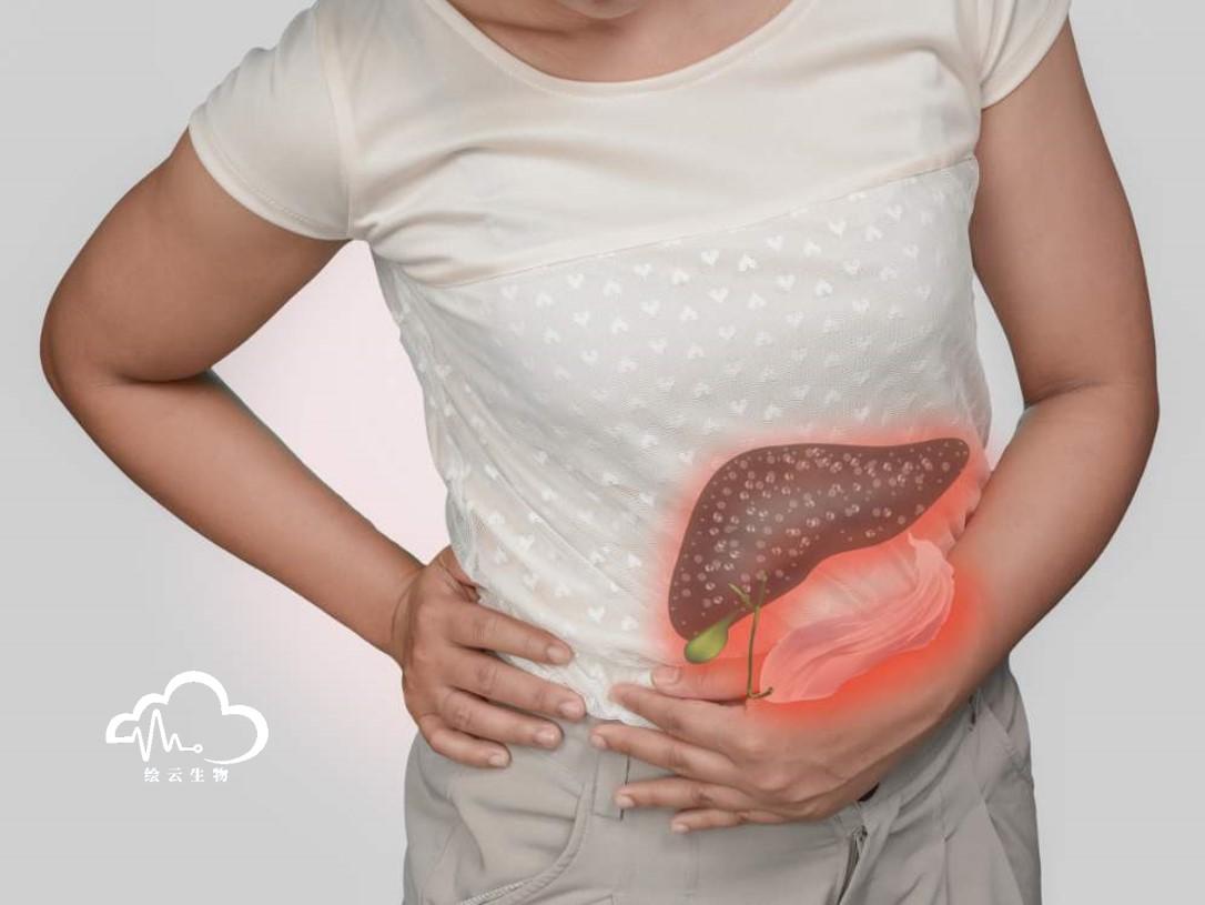 胆汁酸代谢紊乱招来"隐形杀手"肝纤维化