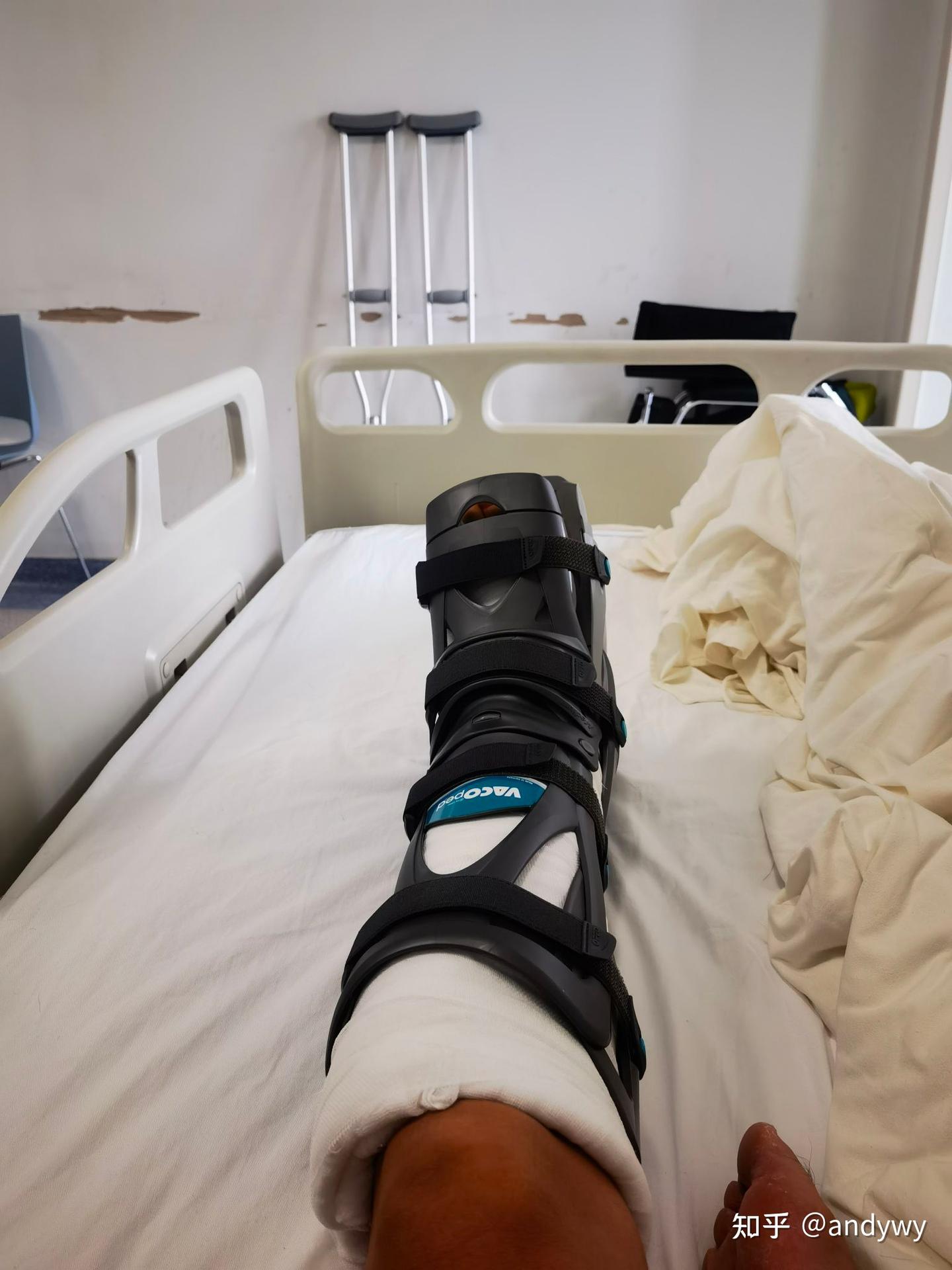 我的跟腱断裂手术康复之路。持续更新… - 知乎
