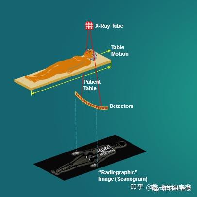CT基础知识——扫描方式 - 知乎