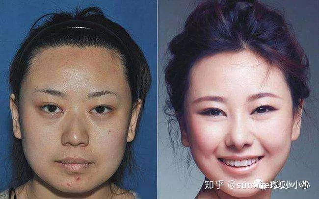 自然的整形标准,在于"度"的把握,无论是求美者要求的差异适度,还是