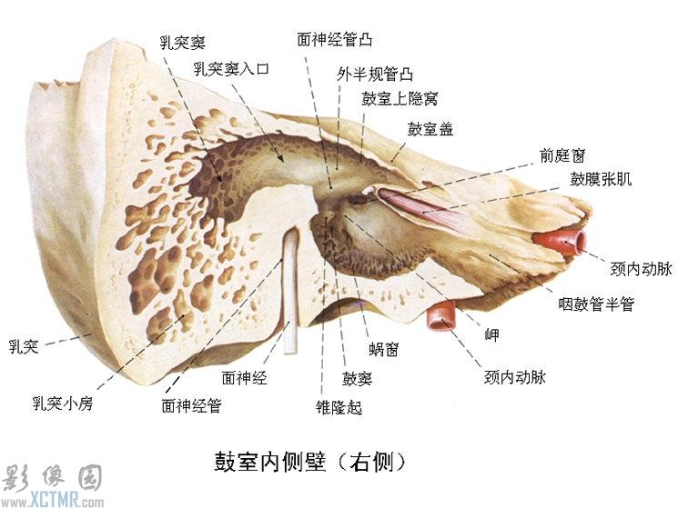 中耳乳突窦图片