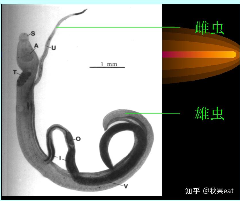 什么是血吸虫 知乎