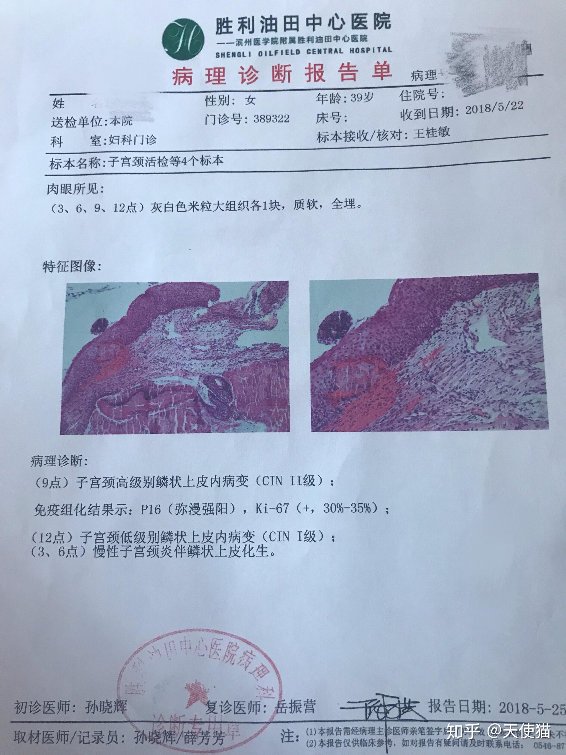 宫腔镜病理报告图片图片