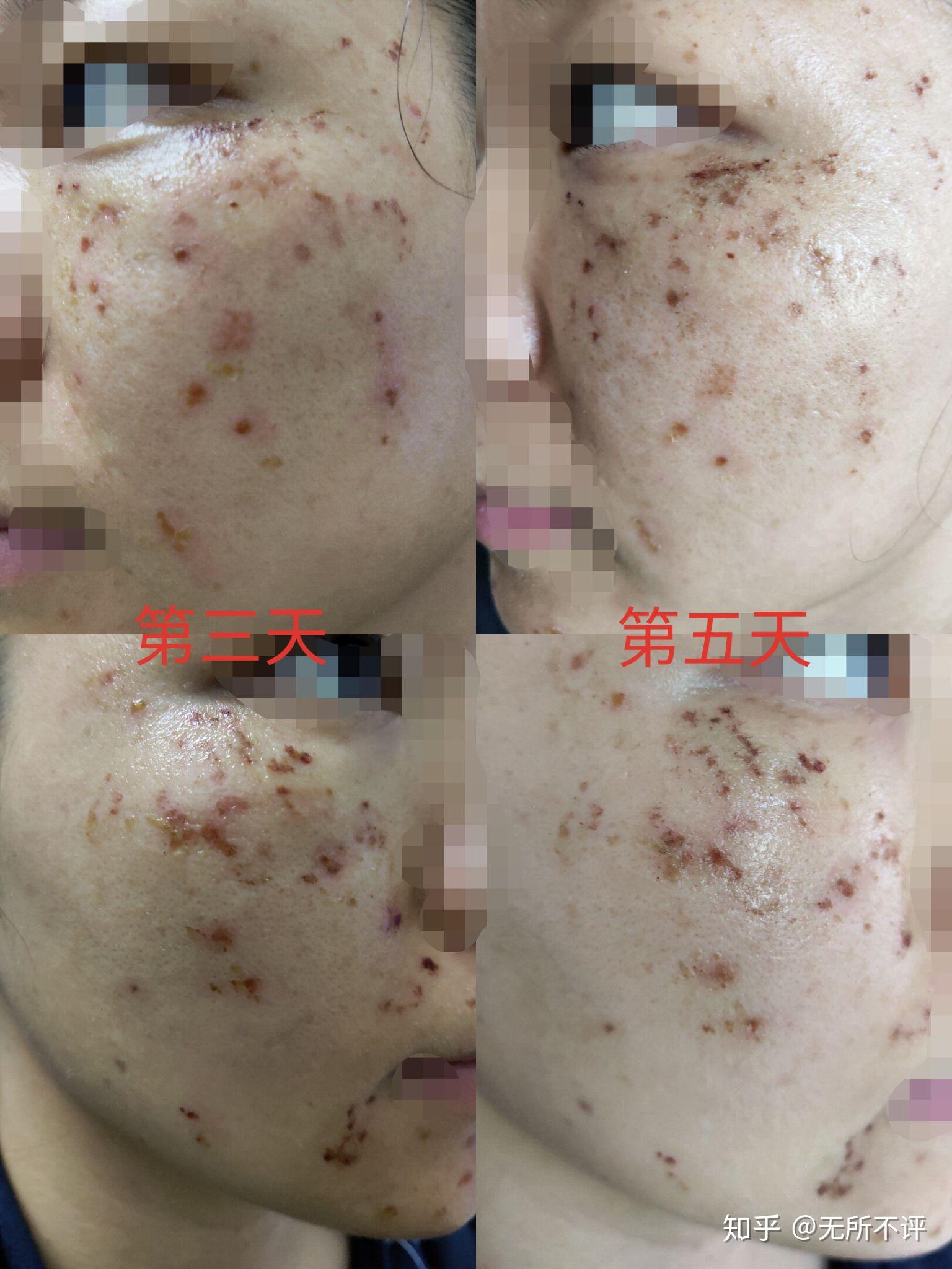 v2-fe2dba69305b26c97cd708902cb0471b_r.jpg