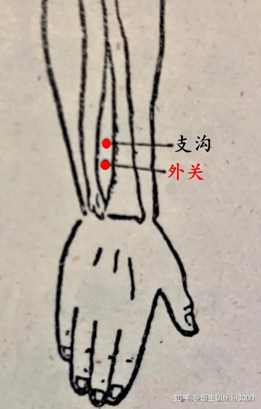简易针灸治疗 扭伤 - 知乎