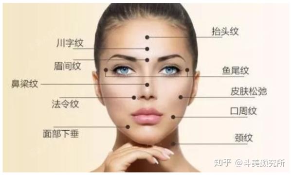 面部颜值“纹”题 | 静态纹和动态纹傻傻分不清楚？这篇文章帮你轻松搞定！ - 知乎