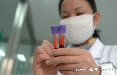 无创静脉血正常饮食,不需要空腹,血液抽好储存在试剂管直接用顺丰寄出