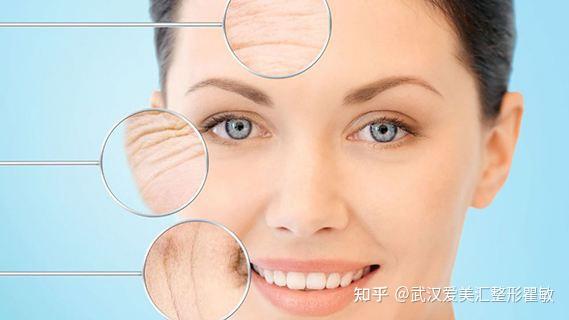 去皱纹最快的3个方法 v2-fe699530c128076dfb3a3f12eefab677_r.jpg