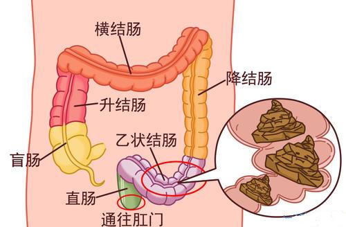 十年的溃结病史教会我的:乐观积极面对,做好持久战准备