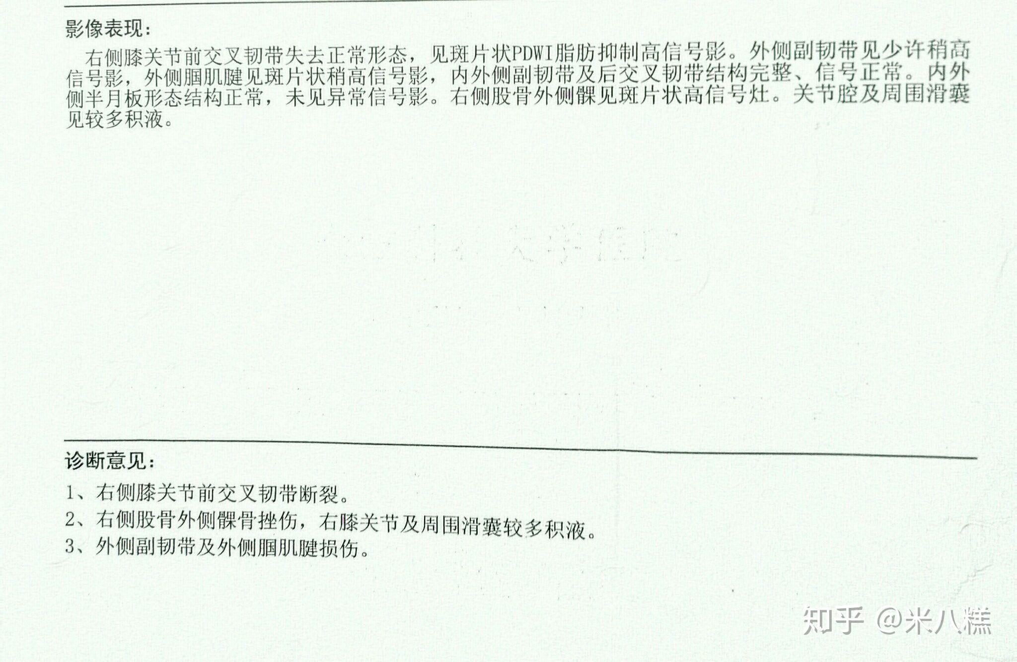 前交叉韧带重建的那些事儿