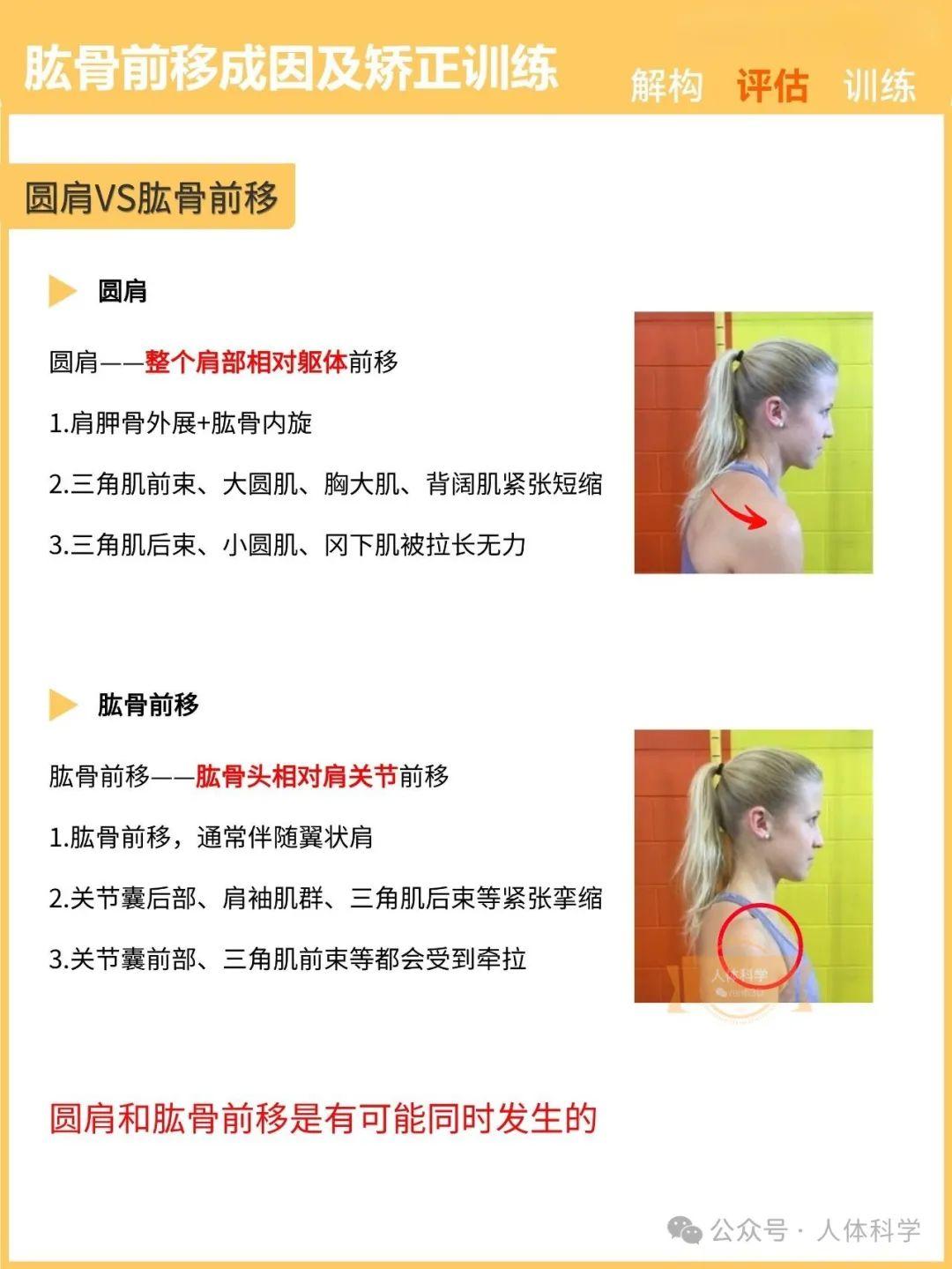 【新体态】肱骨前移的成因及运动矫正训练 - 知乎