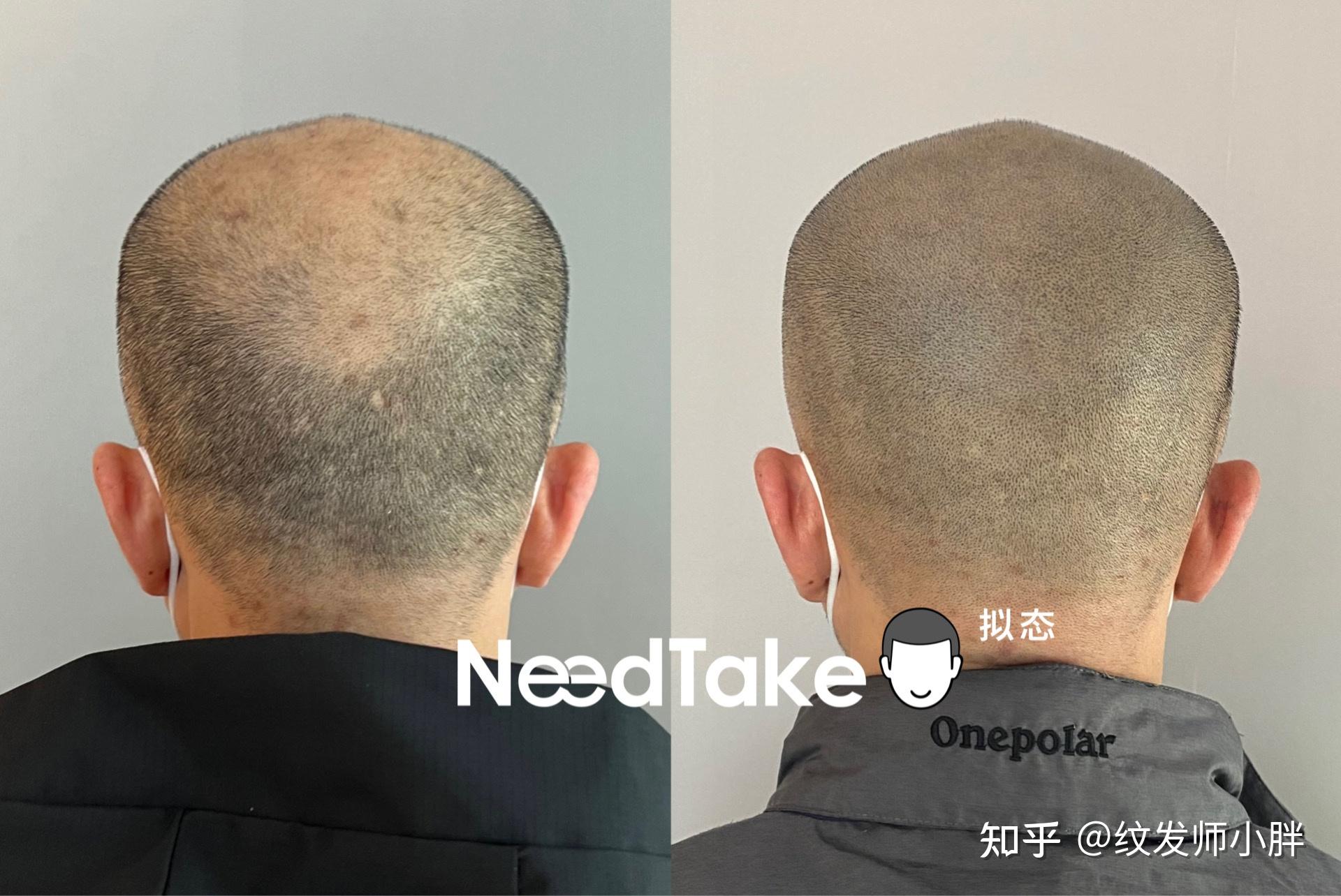 认真听讲！纹发需要多长时间？ - 知乎