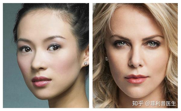 着急想做双眼皮?这些事情你或许应该先了解一下