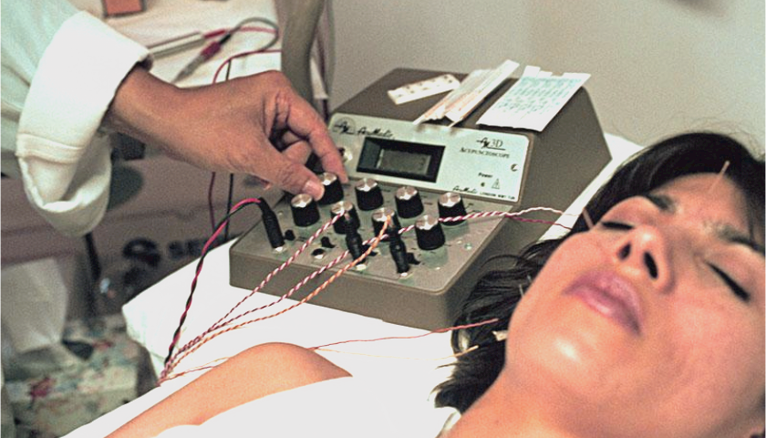 「有时,电针,一种将电流施加到针上的过程,一旦进针之后,可进一步刺激